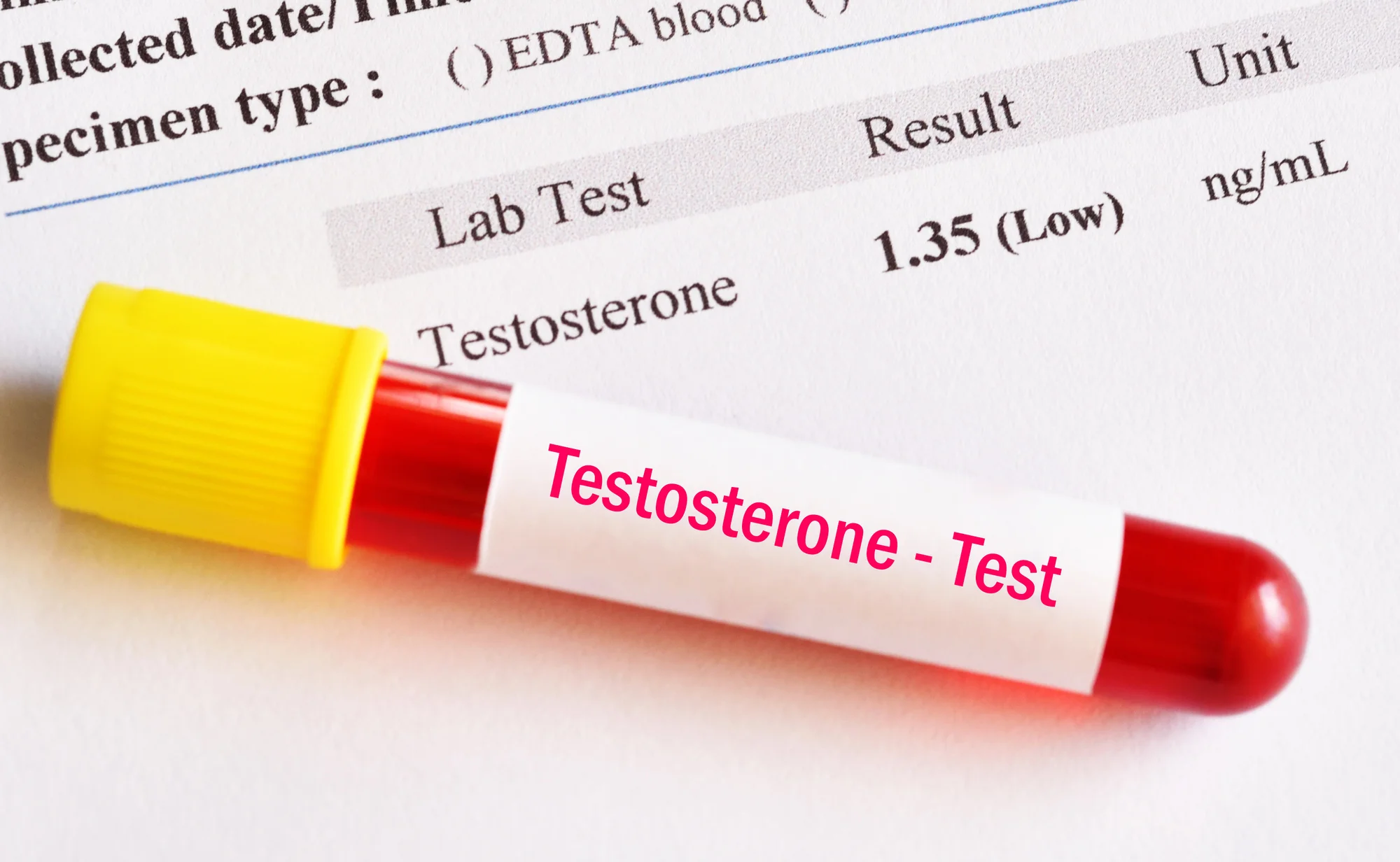 Testosterone